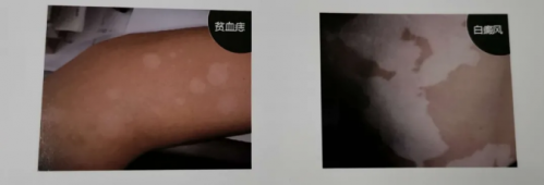 1600050482607700.png 5.png