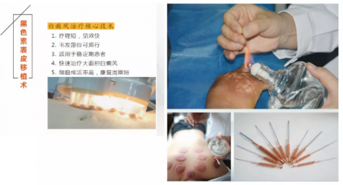 1600050452630783.png 3.png