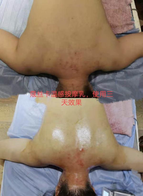 颈椎有救了!蔻丝卡温感滋养按摩精华乳,每天涂一涂疲劳全扫光