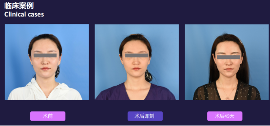 1640852668137238.png image.png