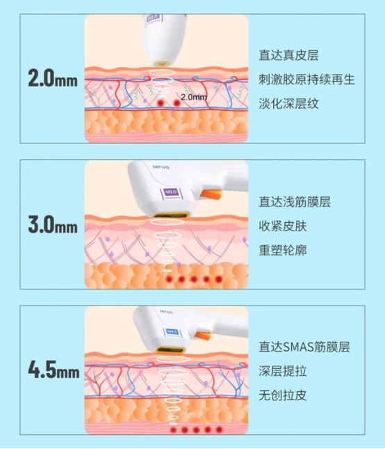 1640852644795360.png image.png