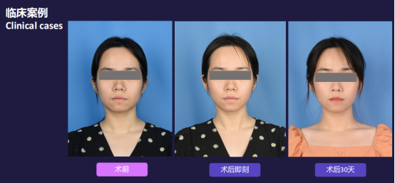 1640852661696165.png image.png