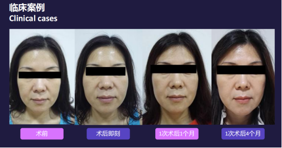 1640852675859062.png image.png